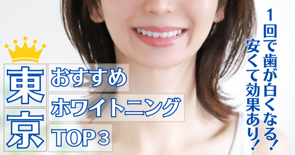 1回で歯が白くなるのに安い！東京のおすすめホワイトニングTOP3